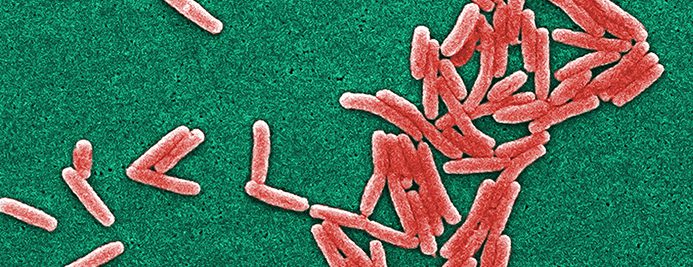 Xylem detuvo mortal brote de legionella